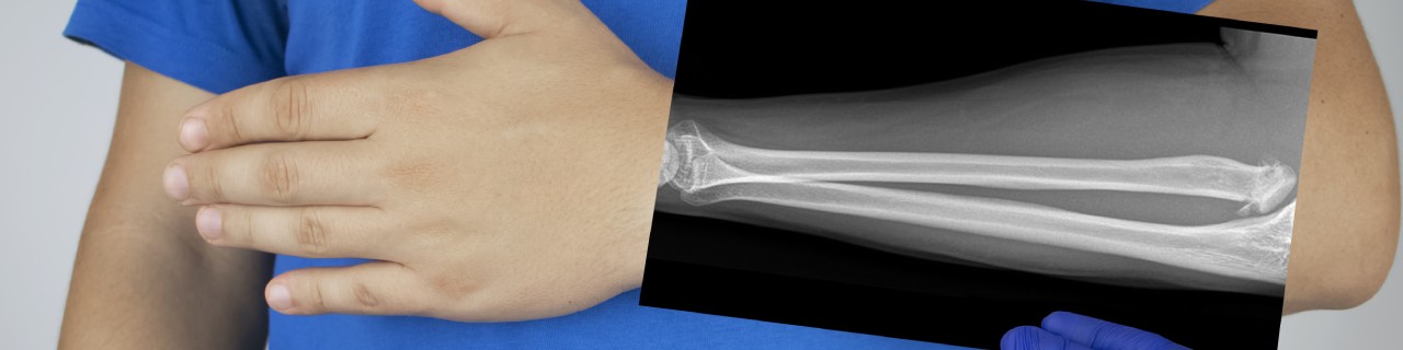 X-ray of a Man's Forearm
